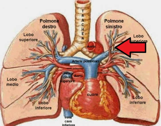 La morte di Nelson, il ramo dell'arteria polmonare lesionato dal proiettile